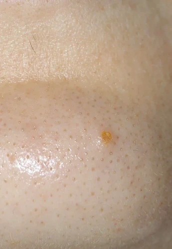 help-unknown-skin-condition-v0-zpzu0optvksd1