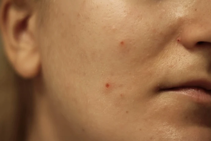 help-unknown-skin-condition-v0-0rqf3gotvksd1