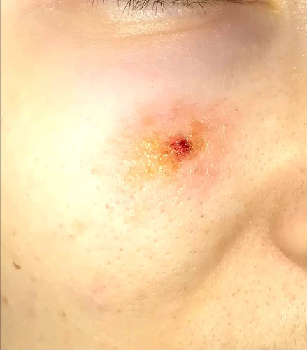help-unknown-skin-condition-v0-wwjvjgotvksd1
